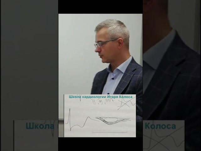 Не путайте ишемию с реципрокными изменениями! #экг #ишемия #игорьколос #бляшка