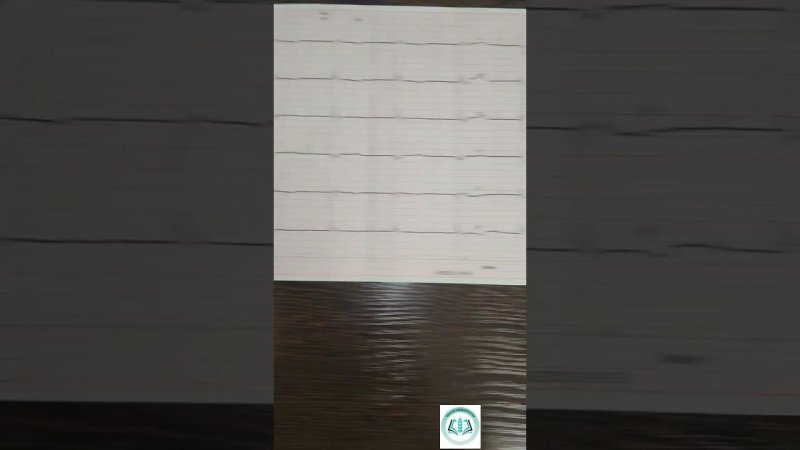 Работа ПЭКС. Отсутствие захвата Р? #экг #экс #кардиостимулятор