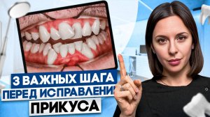Как исправить ПРИКУС БЫСТРО? ВАЖНЫЕ шаги перед лечением прикуса!
