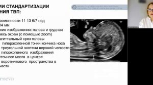 _3.1. Лекция. ТВП