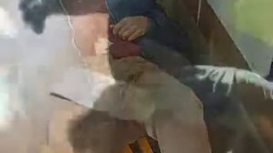 Наложение жгута на бедро