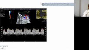 3.6. Лекция. Венозный проток