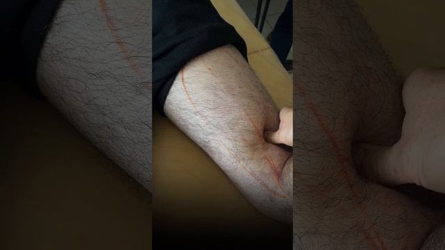 Триггерные точки. Силовой массаж спортсменам.