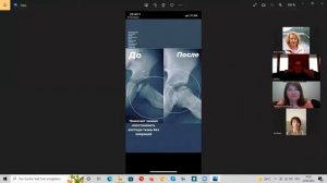 БИ ЛУРОН восстановит суставы, позвоночник  Как работает, какие результаты