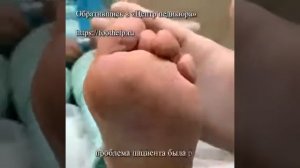 Экзема. Да! И с ней можно справиться!