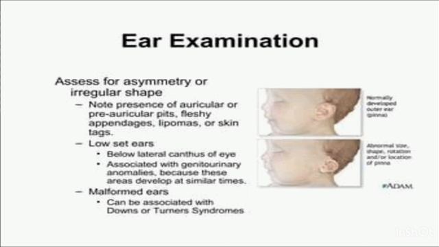 assessment of newborn | initial  | newborn complete examination #nursingeducation #nursinglecture