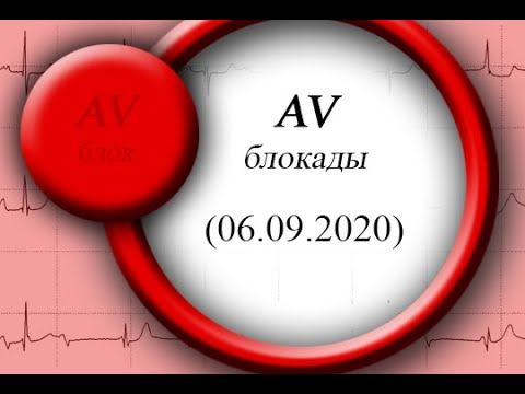 AV блокады