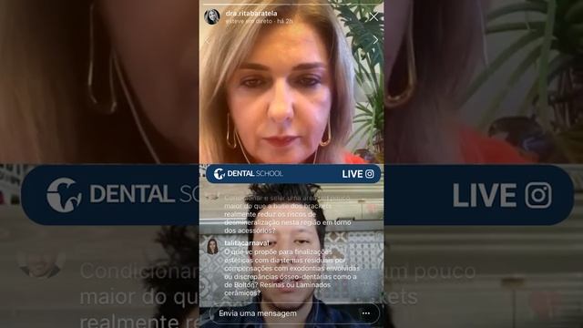 FINALIZAÇÃO ESTÉTICA EM ORTODONTIA - QUANDO E COMO FAZER? - DENTAL SCHOOL