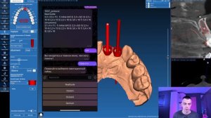 Втулки и оффсеты навигационных наборов в Real Guide, - Что с этим делать? Как делаем это мы?