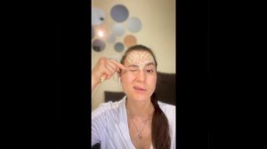 Botulinum therapy practical part with anatomy of the muscles. Ботулинотерапия. ￼#botox #anatomy