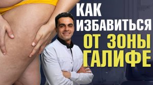 Как убрать зону галифе и другие проблемные места? Пластический хирург Шон Цион