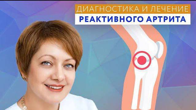 ДИАГНОСТИКА И ЛЕЧЕНИЕ РЕАКТИВНОГО АРТРИТА