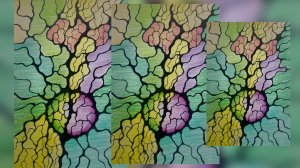 НейроАнгел