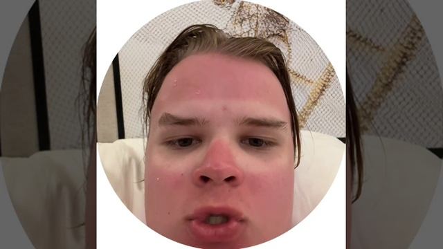 Почему стоит пользоваться солнцезащитным кремом! смотреть онлайн