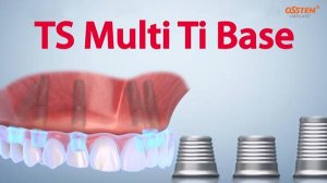 TS Multi Ti Base / Титановые основания