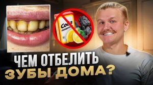 Как отбелить зубы в домашних условиях? РАБОЧИЕ способы отбеливания зубов дома своими руками.