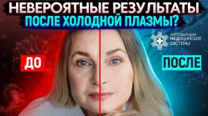 Невероятные результаты Холодной Плазмы ТДМЕДСИ