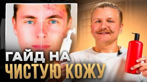 ГАЙД НА ЧИСТУЮ КОЖУ - КАК ИЗБАВИТЬСЯ ОТ ПРЫЩЕЙ и ЧЕРНЫХ ТОЧЕК