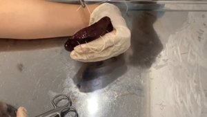 Наложение печеночного шва по Кузнецово-Пенскому