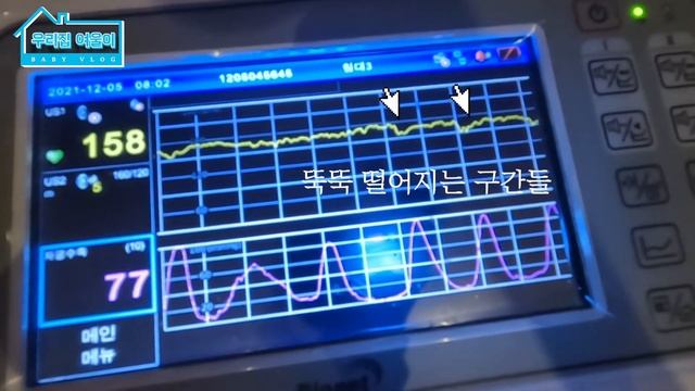 [육아 Vlog] 아기 탄생의 순간, 자연분만을 추구했던 산모가 제왕절개를 하게된 사연 (feat. 여울이)ㅣ #출산후기 смотреть онлайн