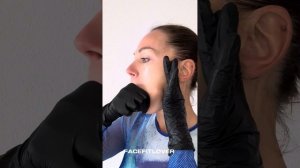 Тренировка для лица  «Буккальный массаж»