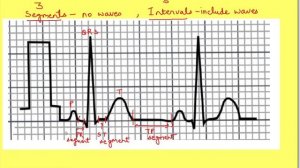 Waves, segments and intervals in ECG (EKG) | ECG basics | Cardiovascular Physiology