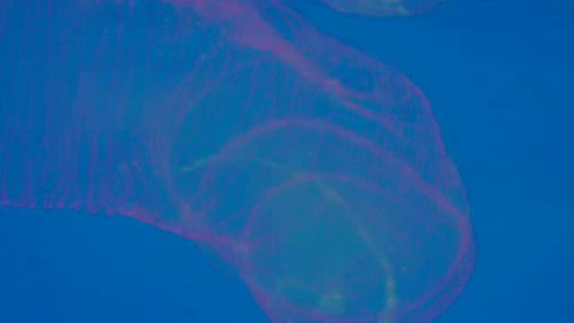 Медуза смотреть онлайн