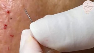 Satisfying and Relaxing with Beauty Spa Videos #37