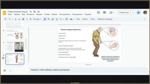 Нарушение экстрапирамидной системы. Неврология 4 курс.