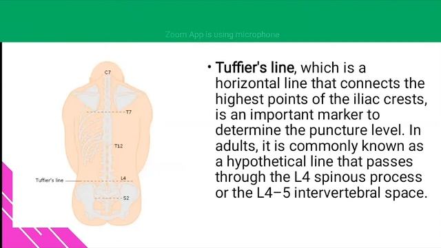 AFAN NeuroAnatomy series  Spinal Cord part 1