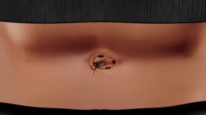ASMR Satisfying navel stone removal animation‼️, Body Skin Care