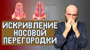 Искривление носовой перегородки. Почему есть у каждого?
