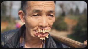 5 РЕАЛЬНЫХ ЛЮДЕЙ МУТАНТОВ!!! ЖЕСТЬ ВИДЕО!!!