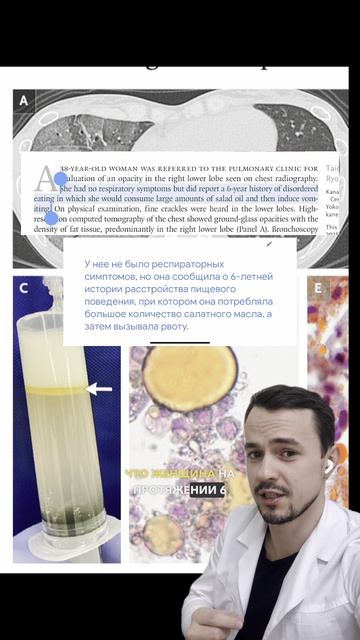 РПП. Рекомендации для профилактики.