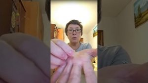 Пример постановки игл СуДжок