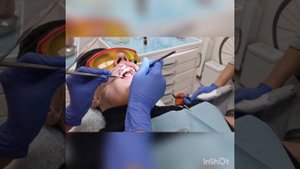 Фиксация ретейнера в стоматологии Химки