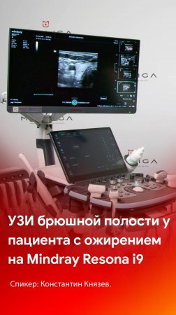 1 часть - тизер УЗИ ОБП тучного пациента. Готовый