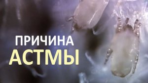 Почему пылевые клещи - самые коварные вредители, которые наверняка живут рядом с вами?