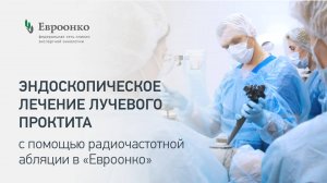 Эндоскопическое лечение лучевого проктита с помощью радиочастотной абляции в «Евроонко»