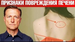 7 РАННИХ признаков повреждения печени