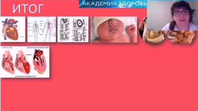 Светлана Лахтеева. Выжимка по инфаркту миокарда