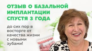 "Эйфория от комфортной жизни" Имплантация
Strategic Implant. 3 года спустя