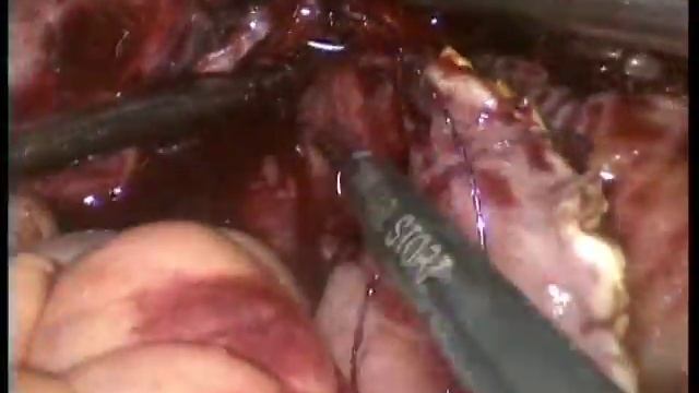 Интракорпоральное формирование энтероцистита модель 2016 смотреть онлайн