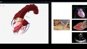 УЗИ сердца для начинающих: парастернальная позиция по длинной оси