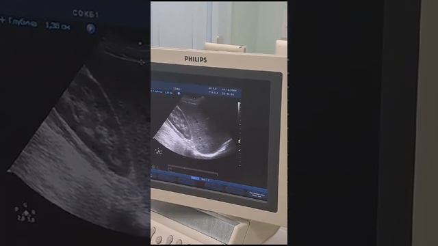 Аккредитация УЗИ печени