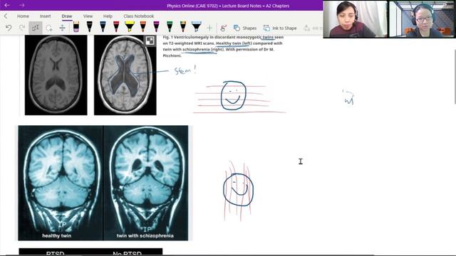 [ARCHIVED] MRI Scans and Answer Examples | A2 Medical Physics | A Levels