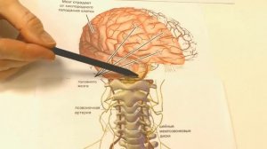 Кратковременная потеря сознания(1)