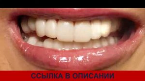 накладные виниры snap on smile отзывы сколько стоят виниры