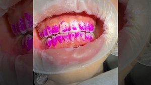 Сивак vs Зубная щетка