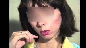 Истерическое расстройство личности и панические атаки.